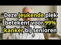 Download Lagu Deze jeukende plek betekent voor 99% kanker bij senioren als het genegeerd wordt.