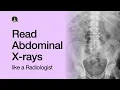 How to Read an Abdominal X-Ray