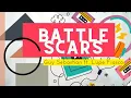 Download Lagu Guy Sebastian ft. Lupe Fiasco - Battle Scars (Lyrics)