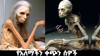 10ሩ የአለማችን ቀጭን ሰዎች 