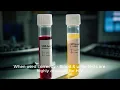 Best At Home STD Test Kits Accuracy Costs and H