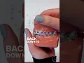 LUCAS ORTHODONTICS - HOW TO WEAR TRIANGULAR CLASS II ELASTICS