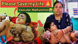 💔 2.5 Saal Ki Baby Rare Disease Se Lad Rahi Hai… Kya Aap Madad Karenge?”