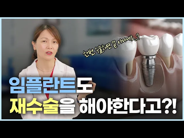 임플란트 재수술 하지 않기 위한 관리법과 추천하는 임플란트 수술
