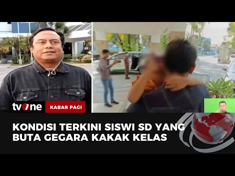 Siswi Alami Buta Gegara Kakak Kelas Jalani Pemeriksaan Jaringan Sistem Pengelihatan