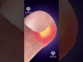 Stop Peeling Hangnails! 😲 #shorts #youtubeshorts - creativelearning3d