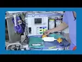 Vapor-Clean Filters for MH-Susceptible Patients - Video 4 of 2