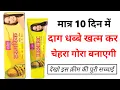 Download Lagu Vi John Turmeric Skin Cream Review | vi john turmeric skin cream kaise use kare