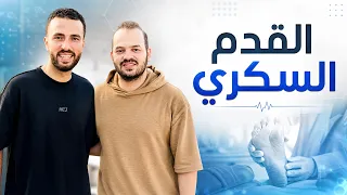 القدم السكري : اعراض القدم السكري  و طريقة العلاج و الوقاية من القدم السكري في المنزل