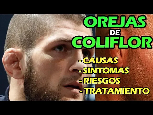 Download MP3 ¿QUE SON LAS OREJAS DE COLIFLOR? - Causas, Síntomas, Riesgos y tratamiento