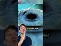 How LASIK Eye Surgery Works