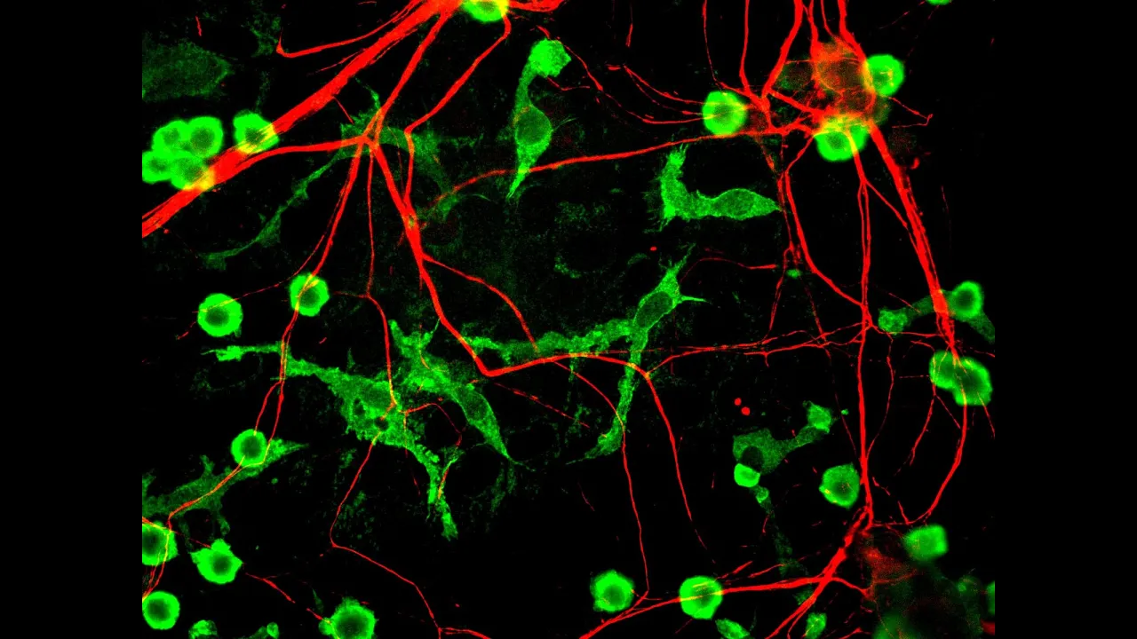 Microglia