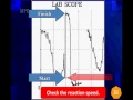 Channel