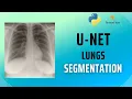 How to segment X-Ray lungs using U-Net and Tensorflow