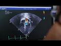University of Florida Cardiology Fellowship Program