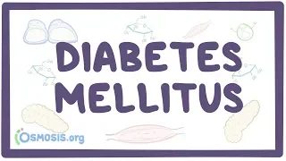 Download Diabetes mellitus (type 1, type 2) \u0026 diabetic ketoacidosis (DKA) MP3