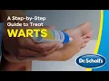 Dr Scholl s How To Use Freeze Away Wart Remover