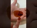 My grandmother from the USA showed me how to clean IODINE from any surface