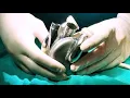 Download Lagu The Texas Heart Institute Implants BiVACOR® Total Artificial Heart