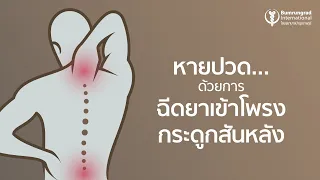 การฉีดยาเข้าโพรงกระดูกสันหลังช่วยรักษาอาการปวดหลังและปวดคออย่างไร