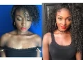 How to Cover Acne Scars with Out Foundation for all shades