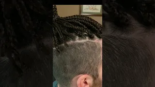 Shaved side under cut hairstyle knoktless braids on shaved sides Before and After
