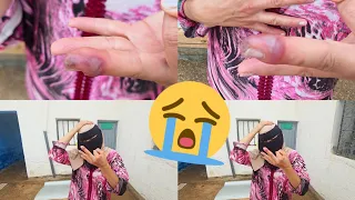                                                        دندنها