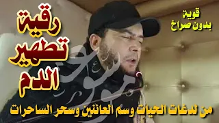 رقية الدم من سم العائنين وسحر الساحرات ولدغ الحيات الراقي المغربي نعيم ربيع 
