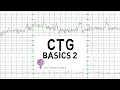 Download Lagu CTG Basics Part 2 - Decelerations \u0026 Fetal Physiology
