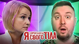 Я соромлюсь свого тіла ► Лікарі не допоможуть Вперше в історії проєкту