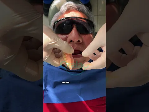 Prótesis flexibles #protesisdental