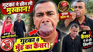 खैनी गुटखा खाने से हुआ मुंह में कैं'स'र नहीं मिला ई'ला'ज 