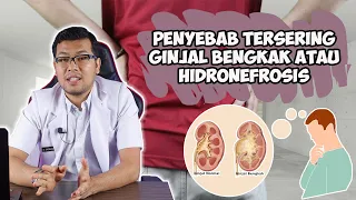 penyebab tersering ginjal bengkak atau hidronefrosis dokter saddam ismail