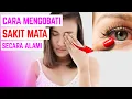 Download Lagu SAKIT MATA! CARA MENGOBATI MATA MERAH SECARA ALAMI