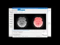 Diffusion MRI processing and reconstruction using DSI Studio