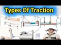 Types Of Traction Traction Types Orthopaedic Traction skin and skeleton