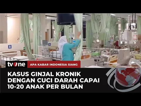 RS Hasan Sadikin Bandung Rawat 5 Pasien Anak Cuci Darah