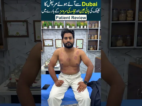 He Watched Our Hijama Videos in Dubai & Came to Pakistan for Treatment | Real Patient Experience