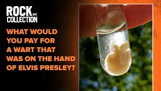 Elvis Presley Collector Shows Off a Wart and Toenail From Singer Rock My Collection