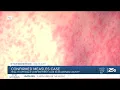Measles case confirmed in McLennan County