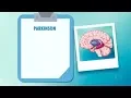 Download Lagu Doença de Parkinson é diretamente influenciada por estado emocional do paciente