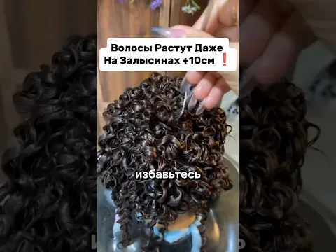 Ампула специально разработана для деликатной стимуляции роста волос #уходзаволосами #выпадениеволос