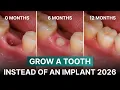 Japanese Technology for GROWING Teeth What Don t Dentists Tell You WHEN Can It Be Done