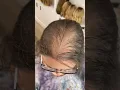 The Most REALISTIC Hair Topper For Hair Thinning ✨ Watch This!