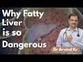 Fatty Liver Dr Arvind Kumar