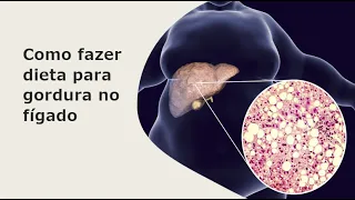COMO FAZER DIETA PARA GORDURA NO FÍGADO
