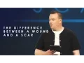 Download Lagu Scars pt 3 - The Difference Between a Wound and a Scar