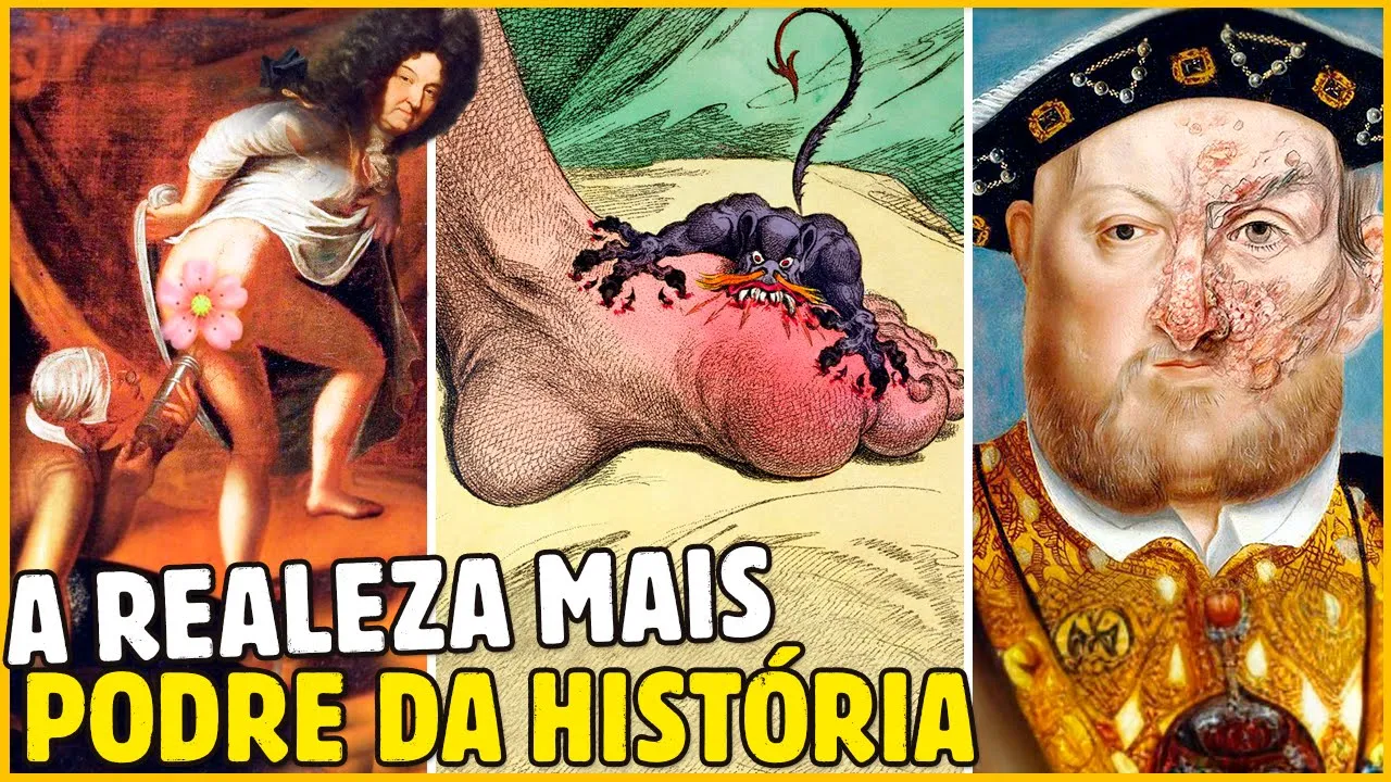 DO "BOTÃO" DE LUÍS XIV ATÉ A GOTA DE HENRIQUE 8º, CONHEÇA A REALEZA MAIS PODRE DA HISTÓRIA