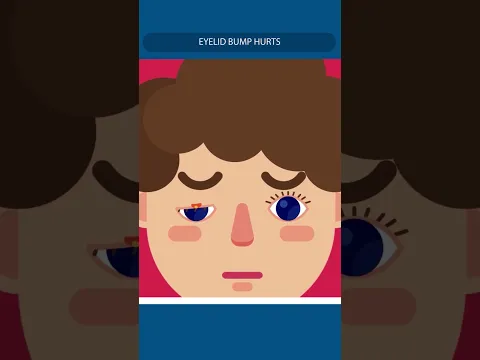 Why Your Eyelid Became Red Overnight