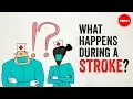 Lagu What happens during a stroke? - Vaibhav Goswami